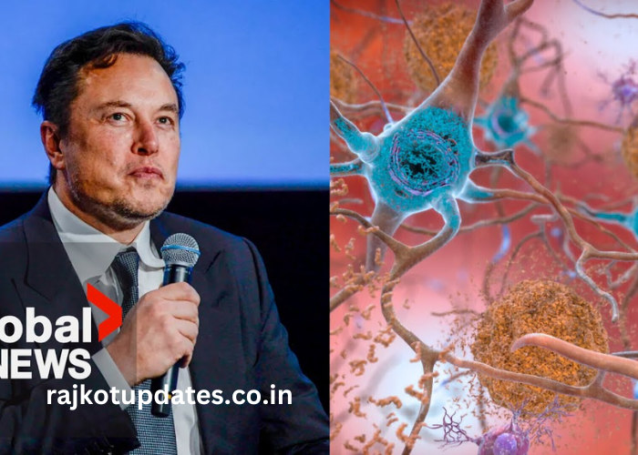 rajkotupdates.news : Elon Musk in 2022 Neuralink Start to Implantation of Brain Chips in Humans